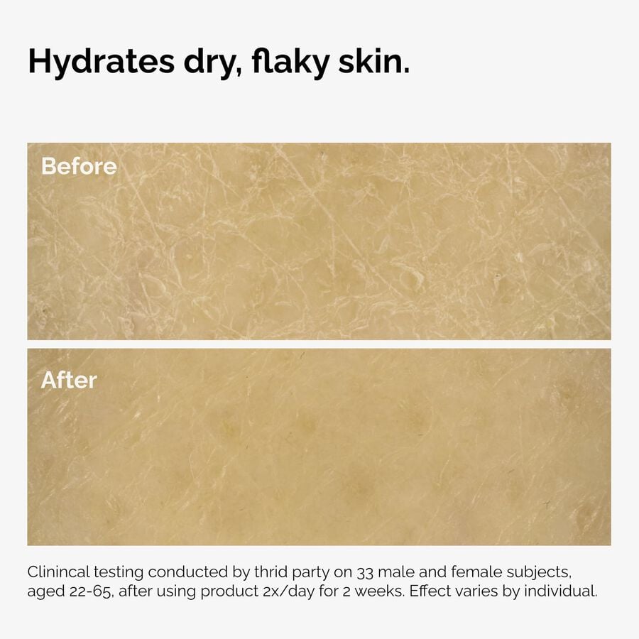 the-body-care-collection-s1 ord-natural-moisturizing-factors-inulin-body-before-after-graphic-02.jpg