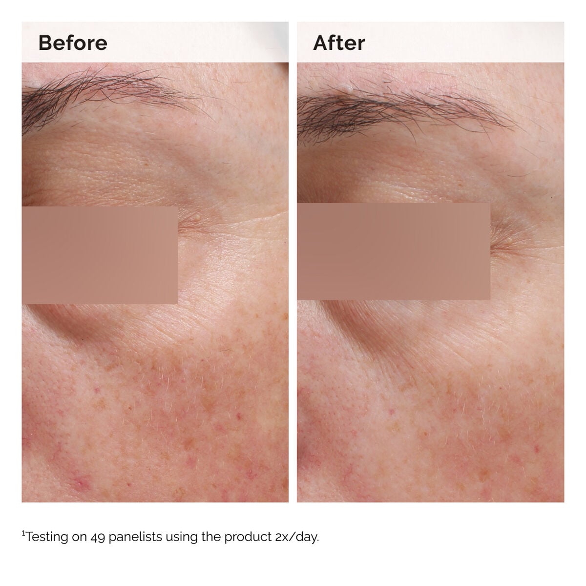 niacinamide-5-face-and-body-emulsion-n0 2024-08-23-ORD-Nia-5pct-Face-Body-B-A-Elasticity-Global-02-1x1.jpg