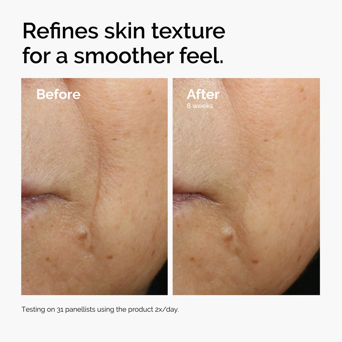 caffeine-3-escin-1-face-serum-m6 ord-caffeine-3pct-escin-1pct-face-serum-before-after-texture.jpg