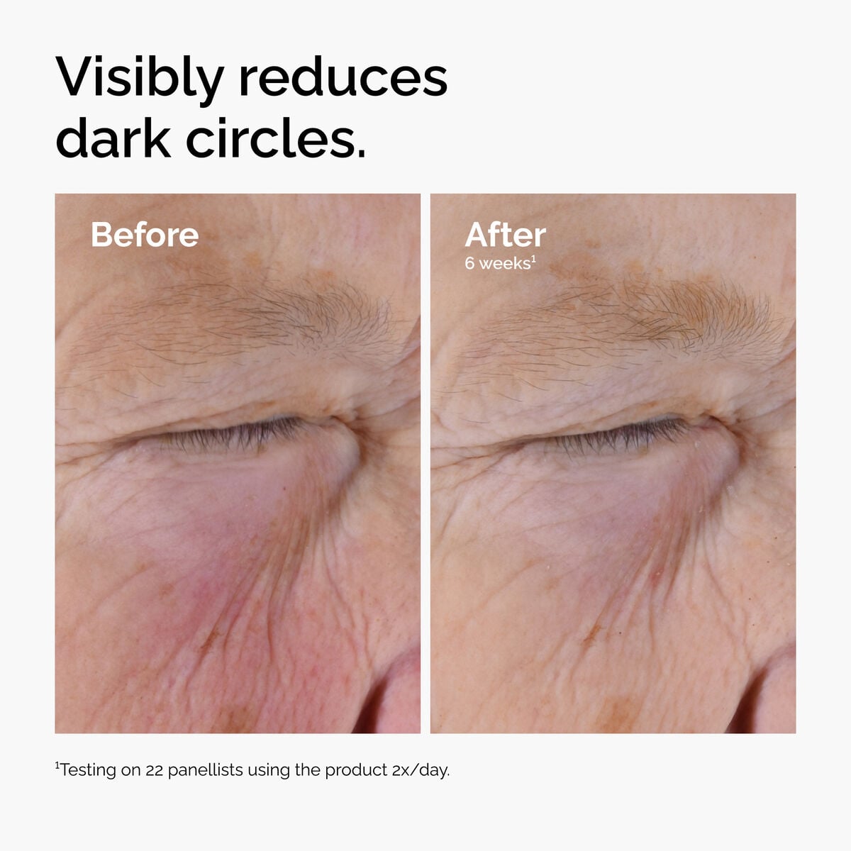 caffeine-solution-5-egcg-eye-serum-u1 ord-caffeine-solution-egcg-dark-circles-before-after.jpg