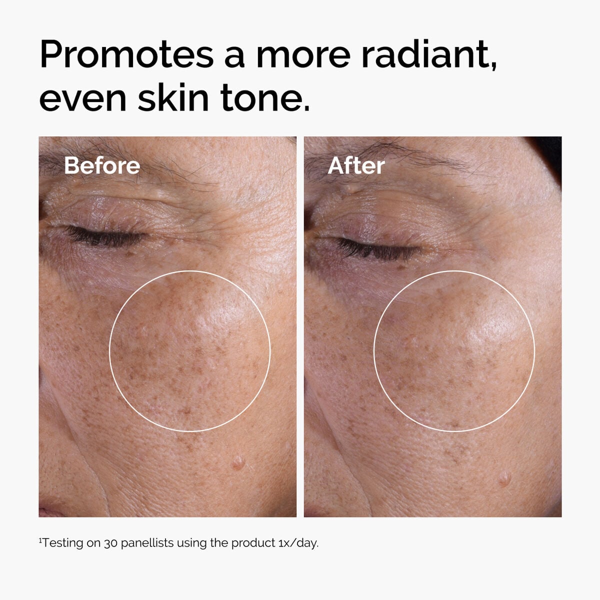 glycolic-acid-7-exfoliating-toner-a6 ord-glycolic-before-after-radiance.jpg