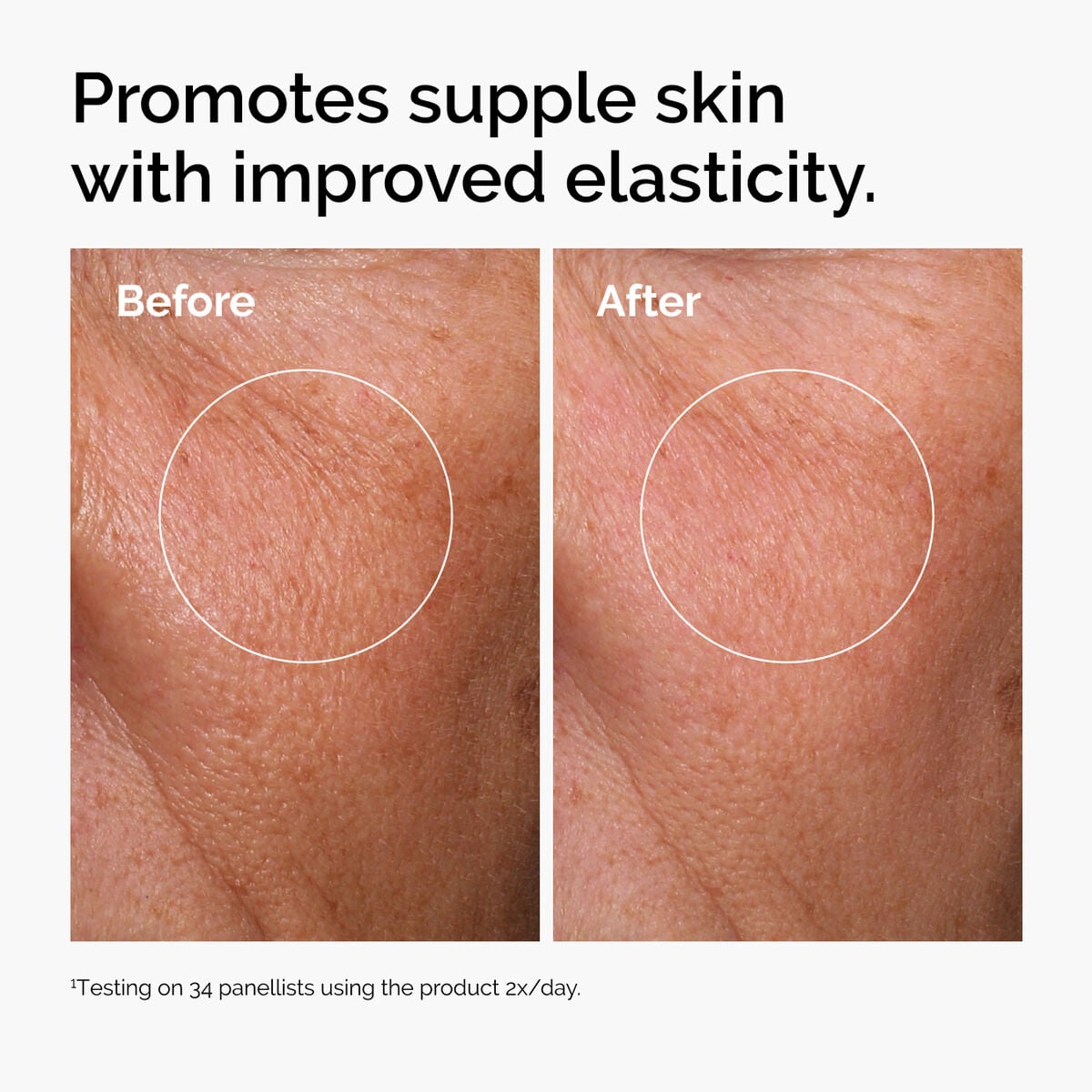 hyaluronic-acid-2-b5-with-ceramides-r1 ord-hyaluronic-acid-2pct-b5-hydrating-serum-before-after-elasticity.jpg