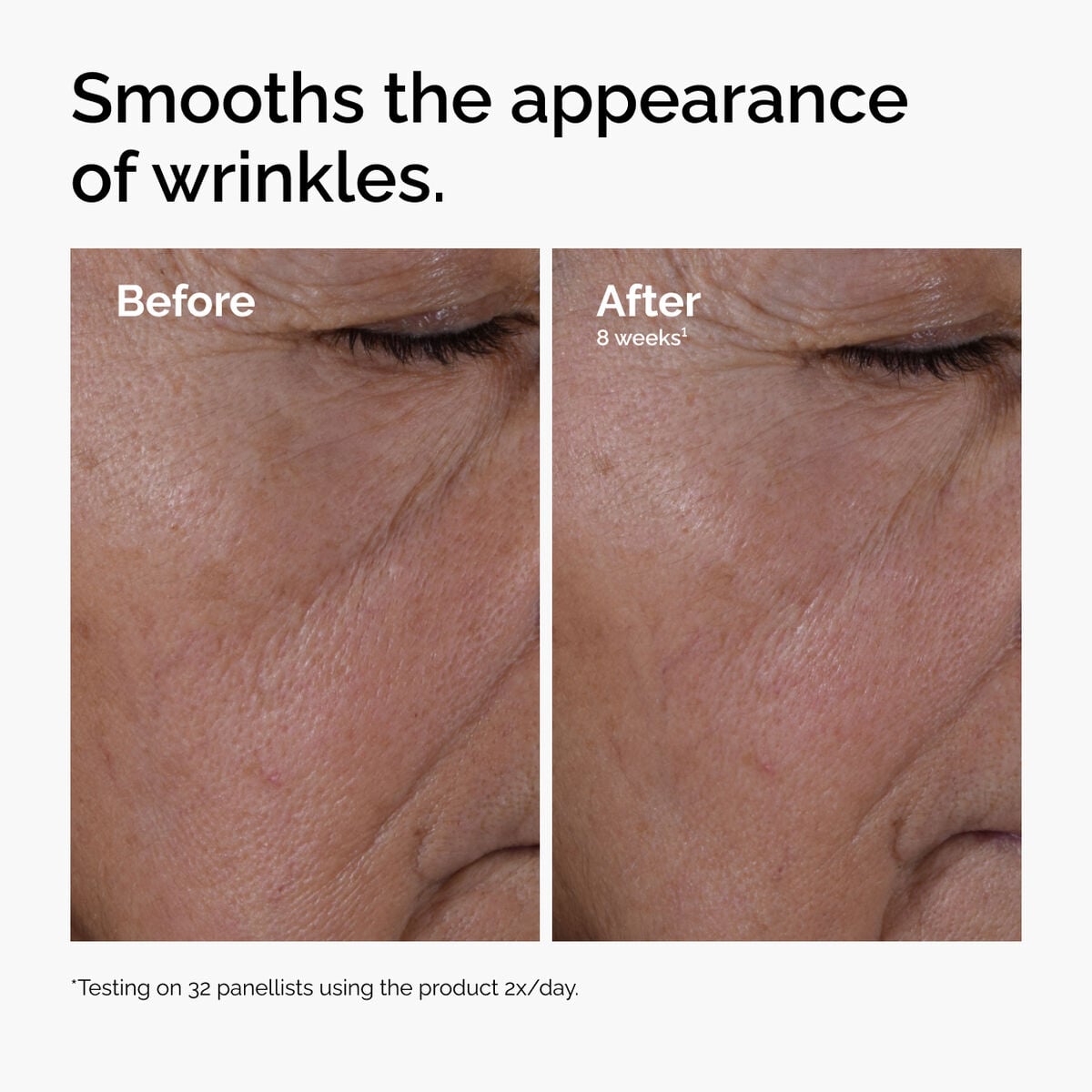 multi-peptide-ha-serum-h2 ord-multi-peptide-ha-serum-wrinkles-before-after.jpg