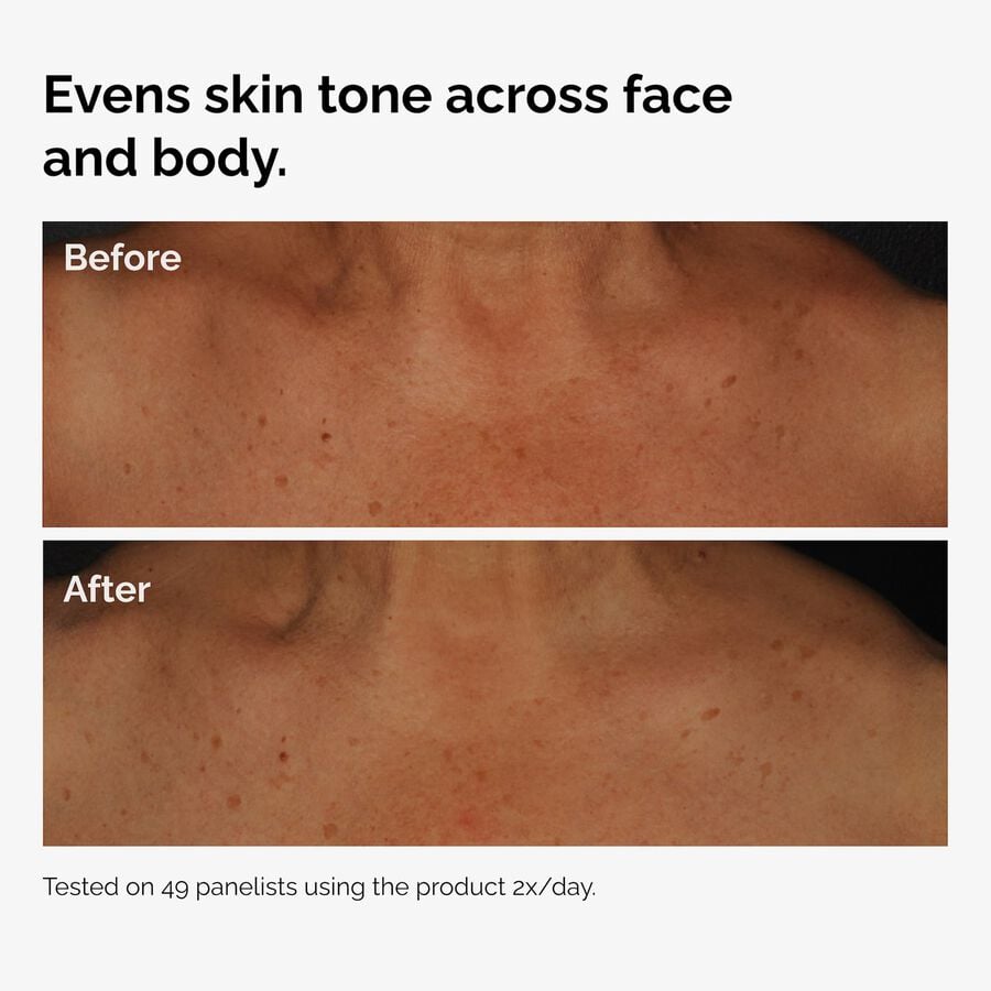 the-body-care-collection-s1 ord-niacinamide-face-body-serum-before-after-even-tone-graphic.jpg