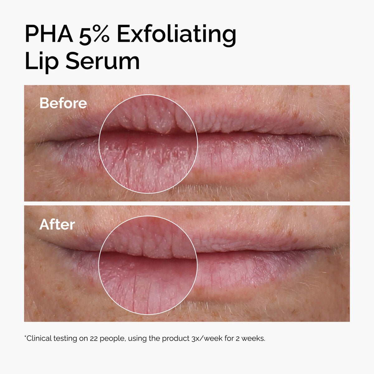 pha-5-exfoliating-lip-serum-r0 ord-pha-5pct-lip-exfoliating-serum-before-after.jpg