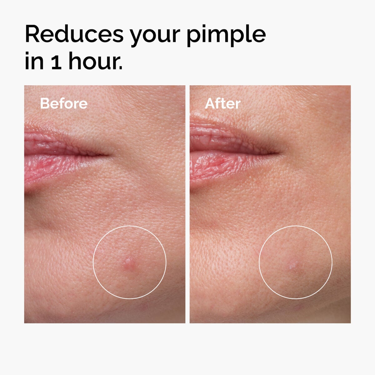 sulfur-10-powder-to-cream-concentrate-y8 ord-sulfur-10pct-powder-to-cream-concentrate-before-after-NA.jpg
